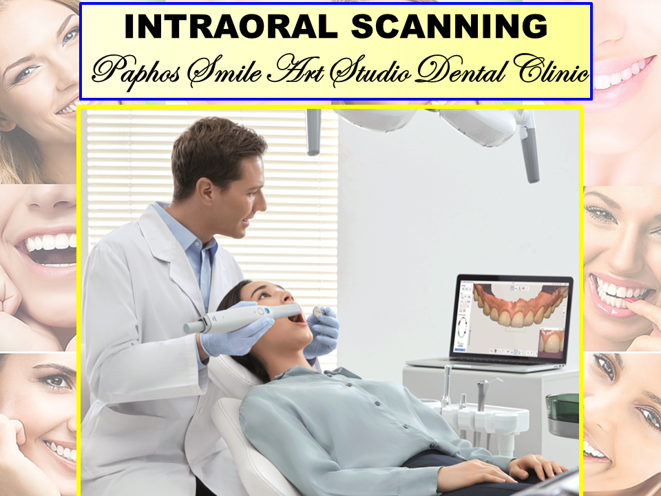 What is an Intraoral Scanner and How Does it Work1